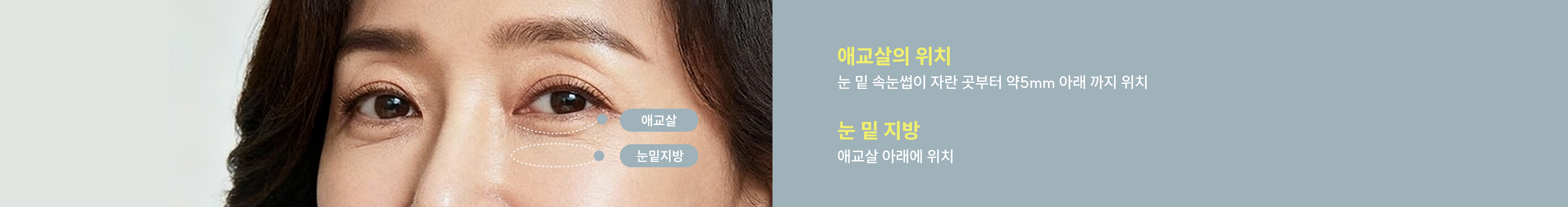 눈밑 다크서클 배너