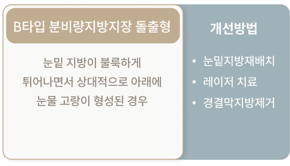 다크서클 타입 2