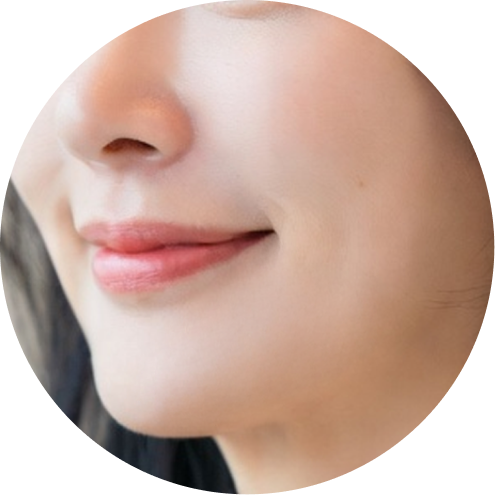 보조개 추천 시술 2