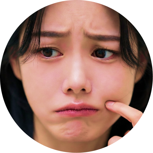 보조개 추천 시술 3